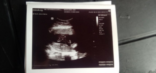 21weeks and 3days Ultrasound