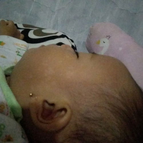 Bercak putih seperti panu awalnya satu titik lama2 melebar ke pipi kanan dan kiri mhon solusinya🙏?