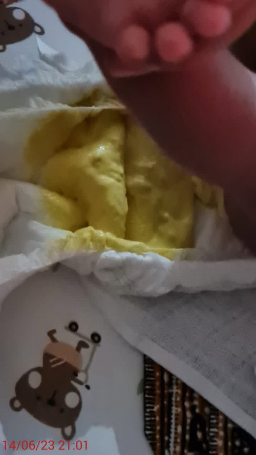 frisolac AR- baby kerap berak