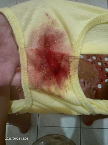 Normal po ba ganitong bleeding after IE?? Kaka IE po saakin kanina. 2cm 38w3days.