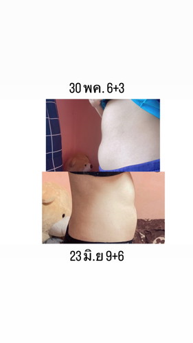 ท้องเล็กไปมั้ยคะ