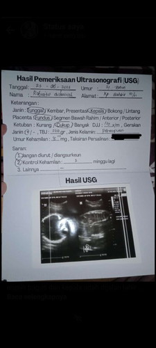 35 Minggu -5 hari