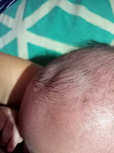 Hello po tanong lang po sana ako bakit malalim yung bonbonan ng baby ko..