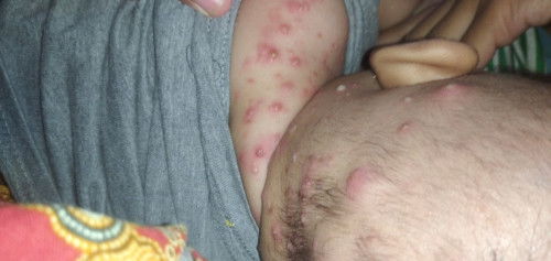 Tanya bun minta pendapat dan solusinya