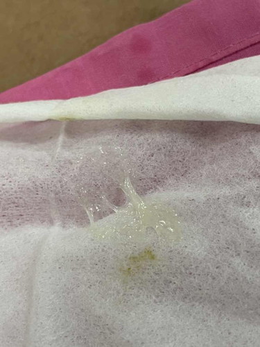 Keputihan dekat newborn
