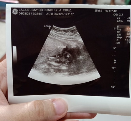 Gender Reveal 21 weeks preggy