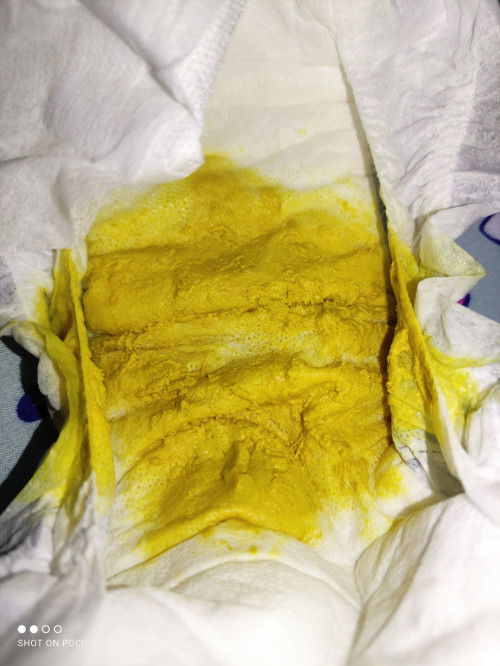 Ilang beses po ba dapat tumae si baby sa isang araw?