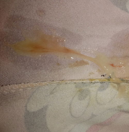 แม่ๆค่ะแบบนี้ควรไปหาหมอไหมค่ะ