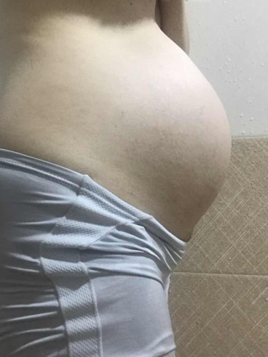Có mom nào bị viêm đường tiết niệu k ạ ? Bụng em tụt mà mỗi lần đè vào bóng đái e đau quá