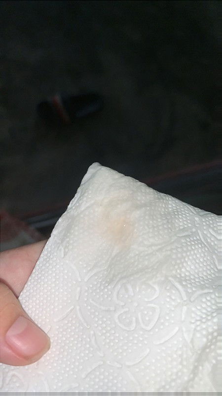 มีมูกใสๆ+มูกเลือด 36+2