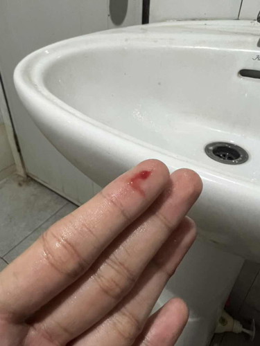 ตรวจปากมดลูก