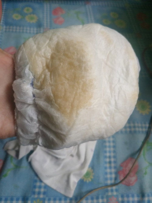 cairan bening lengket pada popok berbau seperti putih telur