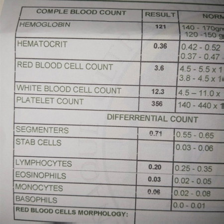 Mga mie ask ko lang po bka may maalam sa inyo magbasa ng result. Tnx po