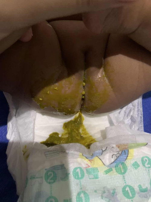 BAB baby umur 1 bln 24hari