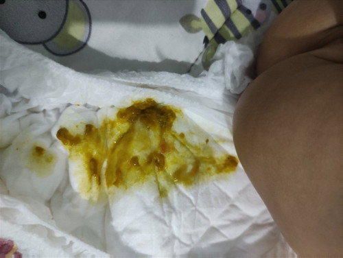Pup bayi diare/bukan?