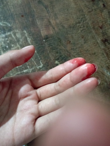เลือดทางช่องคลอด