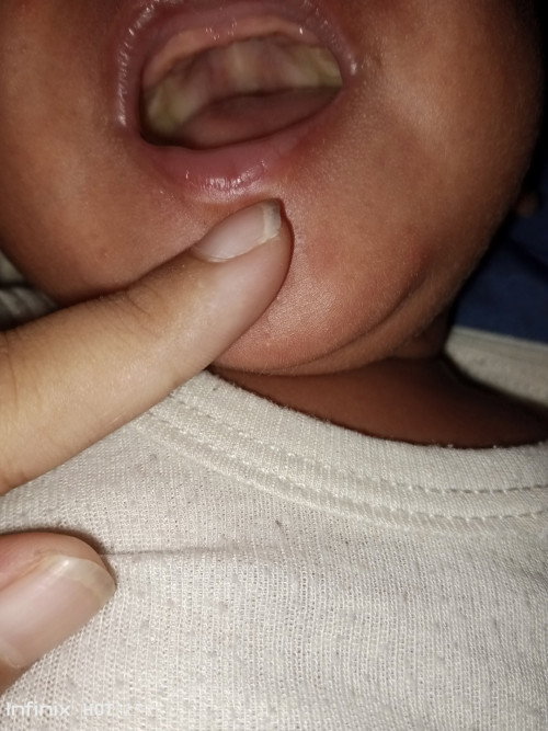 Mulut bayi