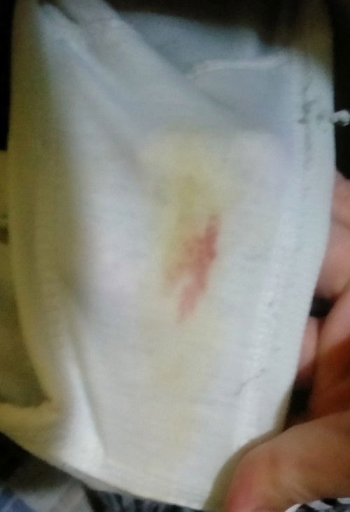 Ngeplek di UK 13week