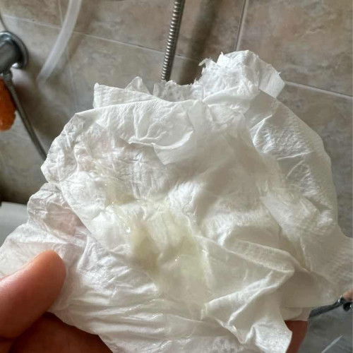 อายุครรภ์ 39+1 คะ