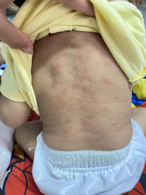 แพ้มั้ยคะ?????