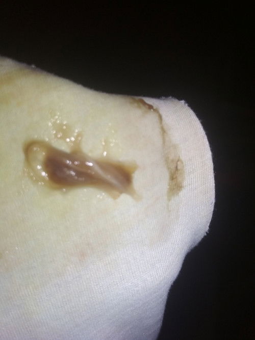 keluar seperti lendir