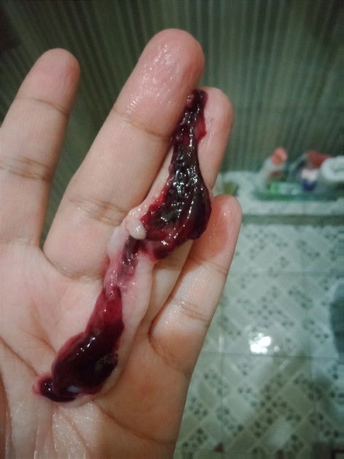 Maaf kalo menjijikan,boleh skip aja