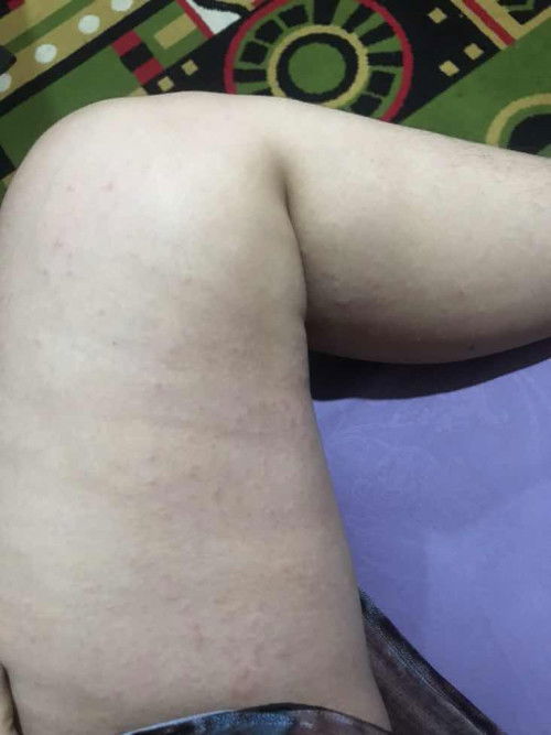 Masalah yang ruam tadi buibu 😢