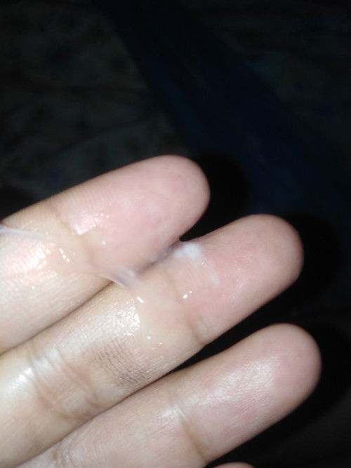 สอบถามน่อยคะ​ มูกใสแบบนี้ใกล้คลอดยังคะ39สัปดาห์​คะ