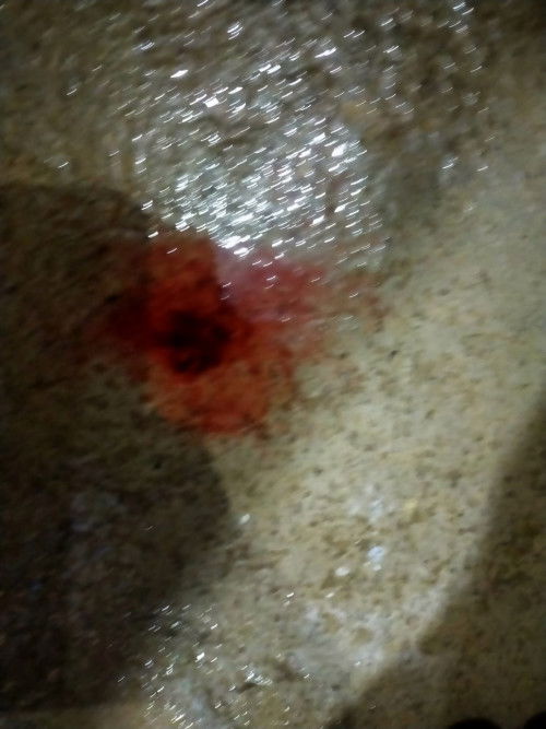 Usia 39 week keluar darah