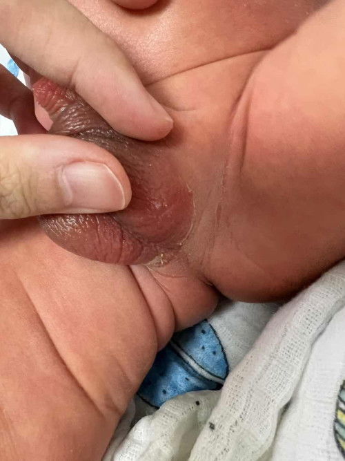 แบบนี้ปกติไหมคะ ขออภัยภาพไม่สุภาพค่ะ