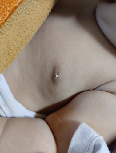 น้องมีเม็ดขาวๆที่หัวนม