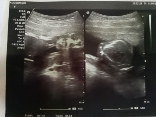 แม่ๆคนใหนดูออกบ้างมั้ยค่ะ อิแม่งงเป็นไก่ตาแตกเลยค่ะ