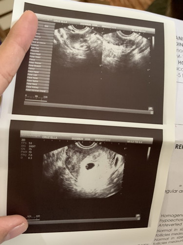 5 Weeks and 6 Days