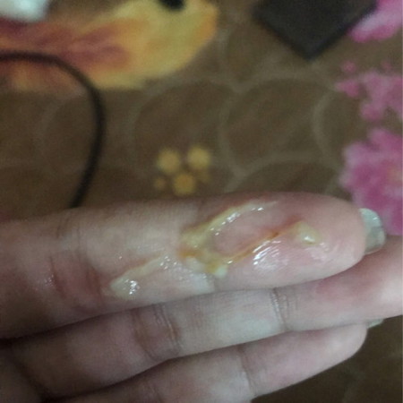 ใช่มูกเลือดมั้ยคะ