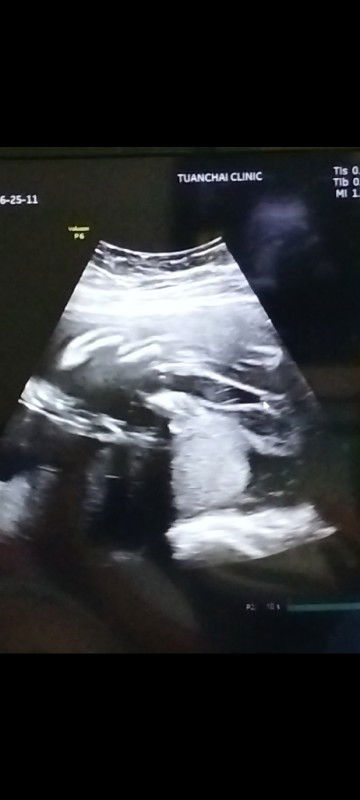 แม่ๆช่วยดูหน่อยค่ะ น้องเป็น ญหรือช