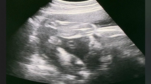 แม่ๆดูเพศให้ทีค่ะ