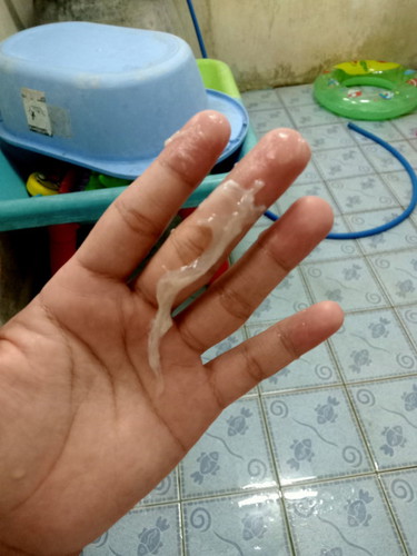 มีมูกใสๆแบบนี้
