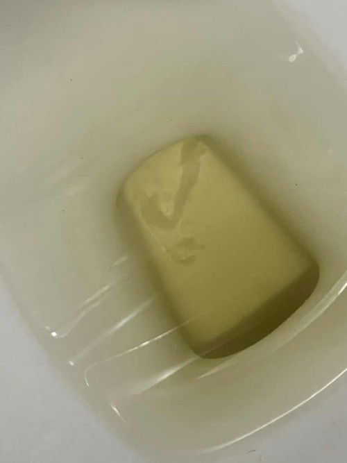 White tissue discharge