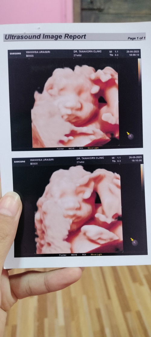 ทีมกันยายน