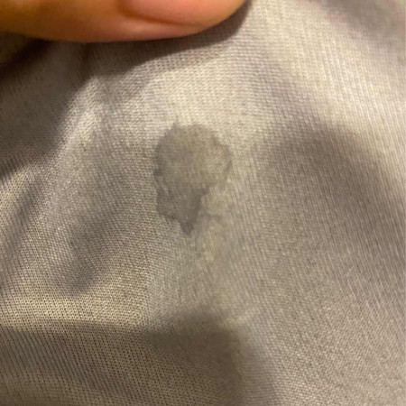 มีคราบเเบบนี้ติดที่เสื้อใน