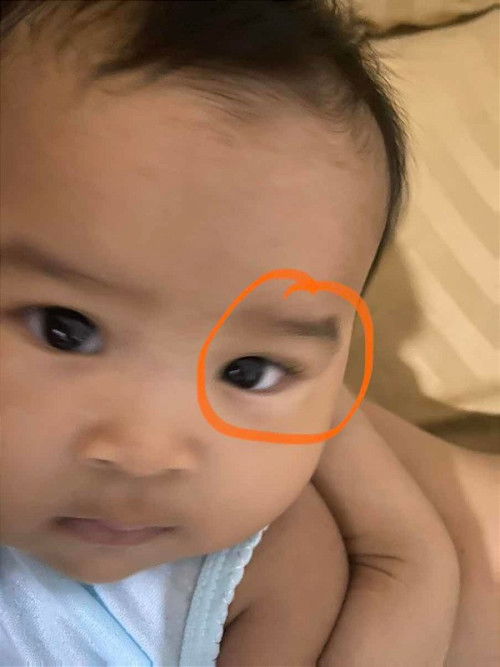 Putih di kantong mata