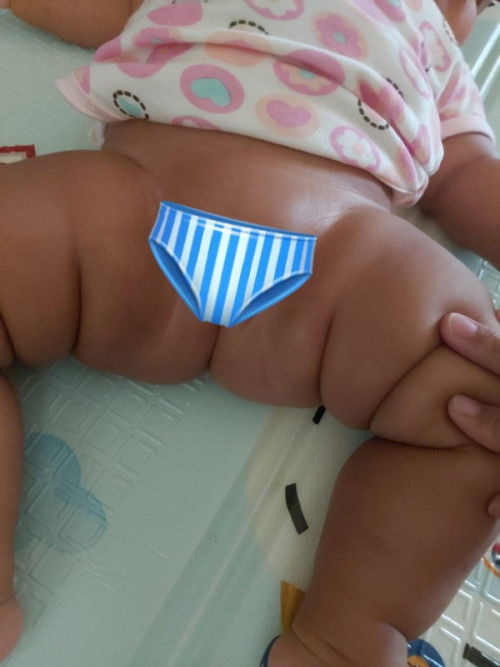 Pantat selangkangan menghitam