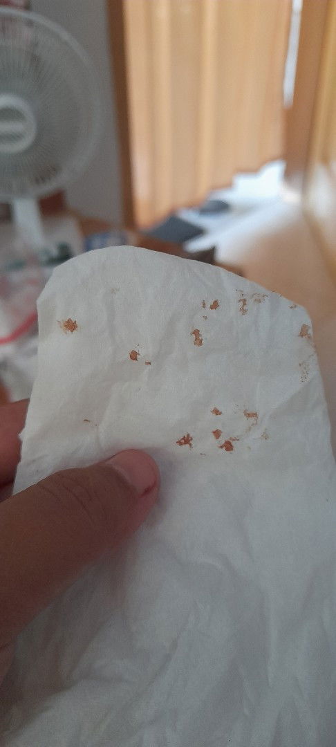 Keluar cairan warna coklat pada puting