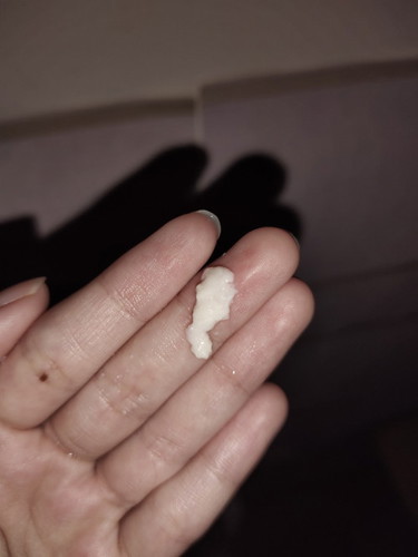 Keputihan kental tebal