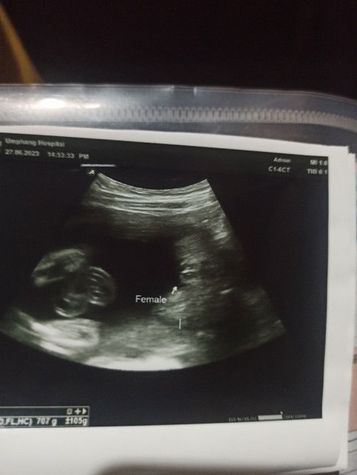 แม่ๆช้วยดูให้น่อยน่ะค่ะว่าเป็นเพศหญิงหรือชายค่ะหมอบอกเป็นเพศหญิงแต่แม่ดูไม่เป็นค่ะ