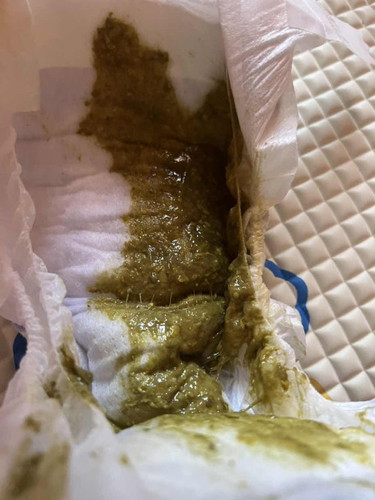 Tolong!! Najis Bayi Tukar Susu Formula