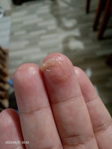 Mucus plug na po ba ito? 38w1d