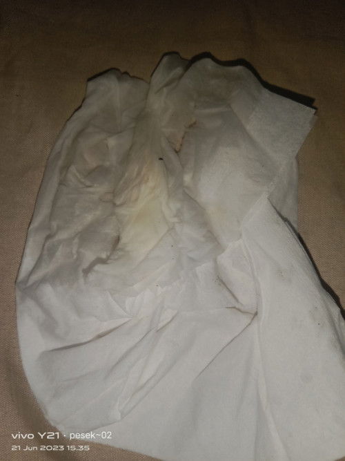 Ketuban rembes apa keputihan