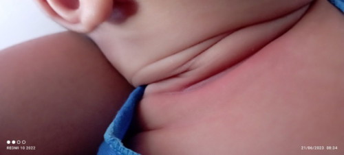 Bun ...tanya pengalamannya donk
Obat ruam di leher yang ampuh itu apa yaa
Baby ku umur 1,5 bulan