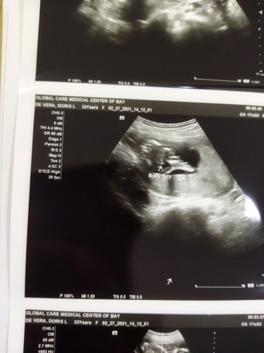 Good morning mga Mi🌞 Ask ko lang po kung sure na ba na baby boy? 4 months pa lang po si baby 😊